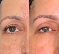 sylfirm olhos2